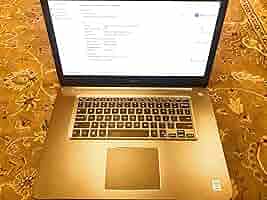 その他 Dell Inspiron 15 7000 Series I7548-2129SLV 15.6-Inch Touchscreen Laptop (5th Gen Core i5-5200U Processor, 1Tb Hard Drive, 6GB RAM, Wind A1Cq64Iu+DL._AC_SY200_QL15_.jpg